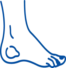 Foot Deformities: Symptoms & Treatment