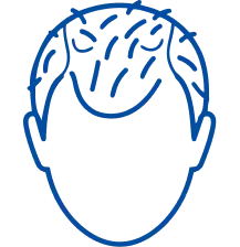 Hair Thinning: Causes, Symptoms & Treatment | Manipal Hospitals