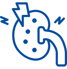 Kidney Stone Treatment in Delhi | Manipal Hospitals