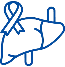 Liver Cancer Treatment in Bangalore | Manipal Hospitals