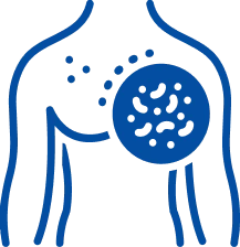 Lymphoma Treatment in Pune | Manipal Hospitals