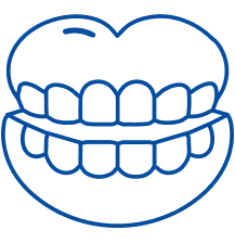 Braces Treatment in Pune | Manipal Hospitals