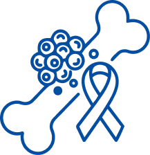 Multiple Myeloma: Symptoms & Treatment | Manipal Hospitals