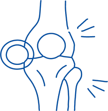 Rheumatoid Arthritis: Symptoms & Treatment