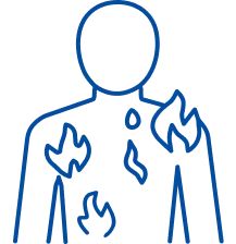 Burn Treatment in Delhi | Manipal Hospitals