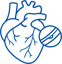 Heart Blockage Treatment in Delhi | Manipal Hospitals