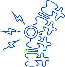 Spinal Cord Injury: Symptoms & Treatment