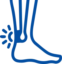 Tendon Injury: Symptoms, Causes & Treatment