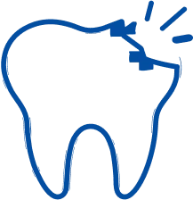 Tooth Decay: Symptoms, Causes & Treatment