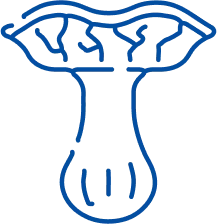 Varicocele Treatment in Pune | Manipal Hospitals