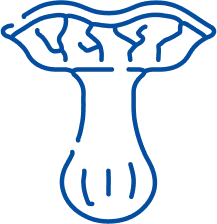 Varicocele
