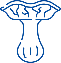 Varicocele Treatment in Bangalore | Manipal Hospitals