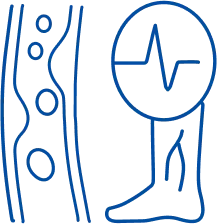Vascular Diseases: Symptoms & Treatment