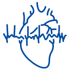 Arrhythmia: Symptoms, Causes & Treatment | Manipal Hospitals
