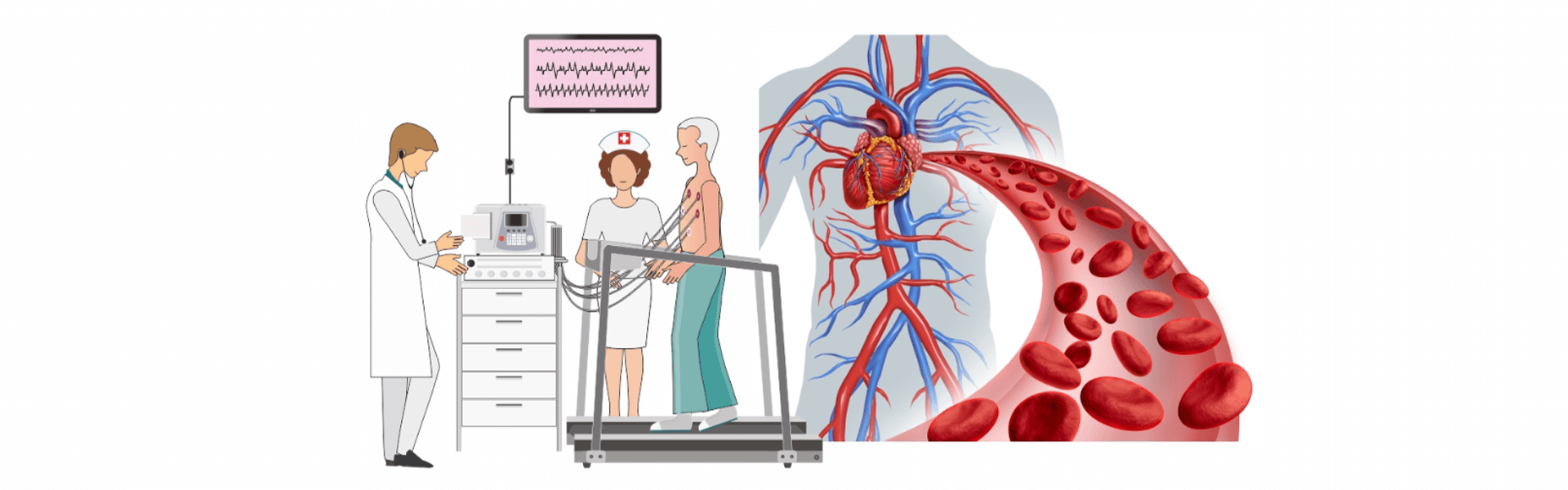 Myocardial Infusion Scan TMT Stress-Instructions