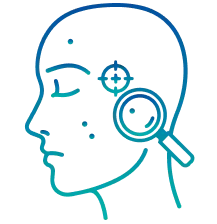 Acne Treatment in Pune | Manipal Hospitals