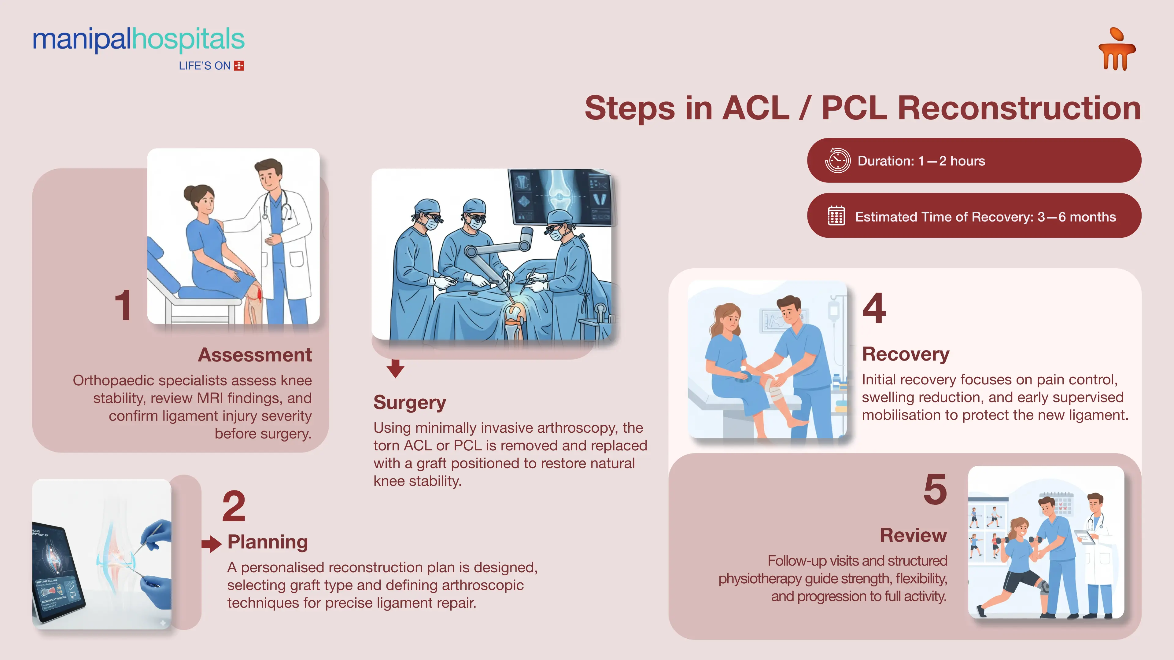 ACL Reconstruction Surgery in Bangalore | Manipal Hospitals