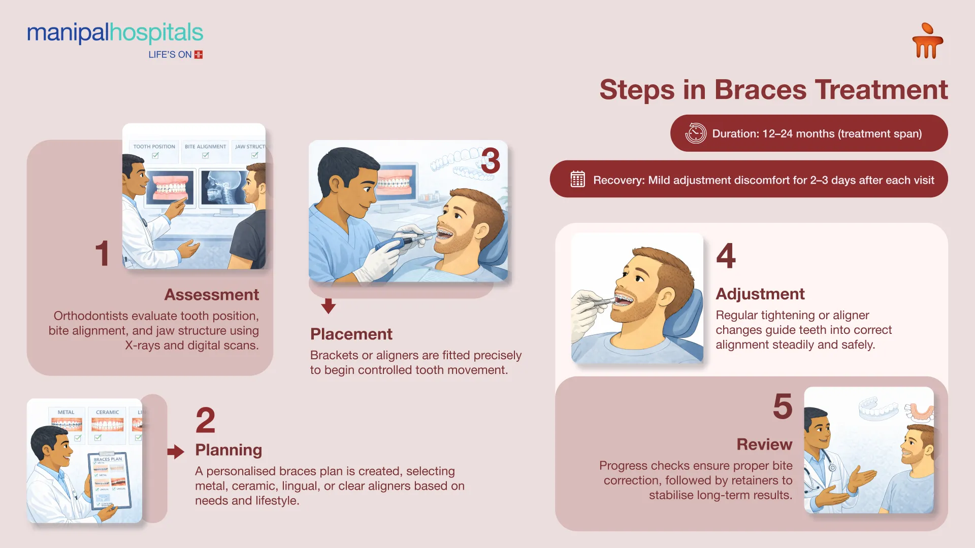 Teeth Braces in Bangalore | Manipal Hospitals
