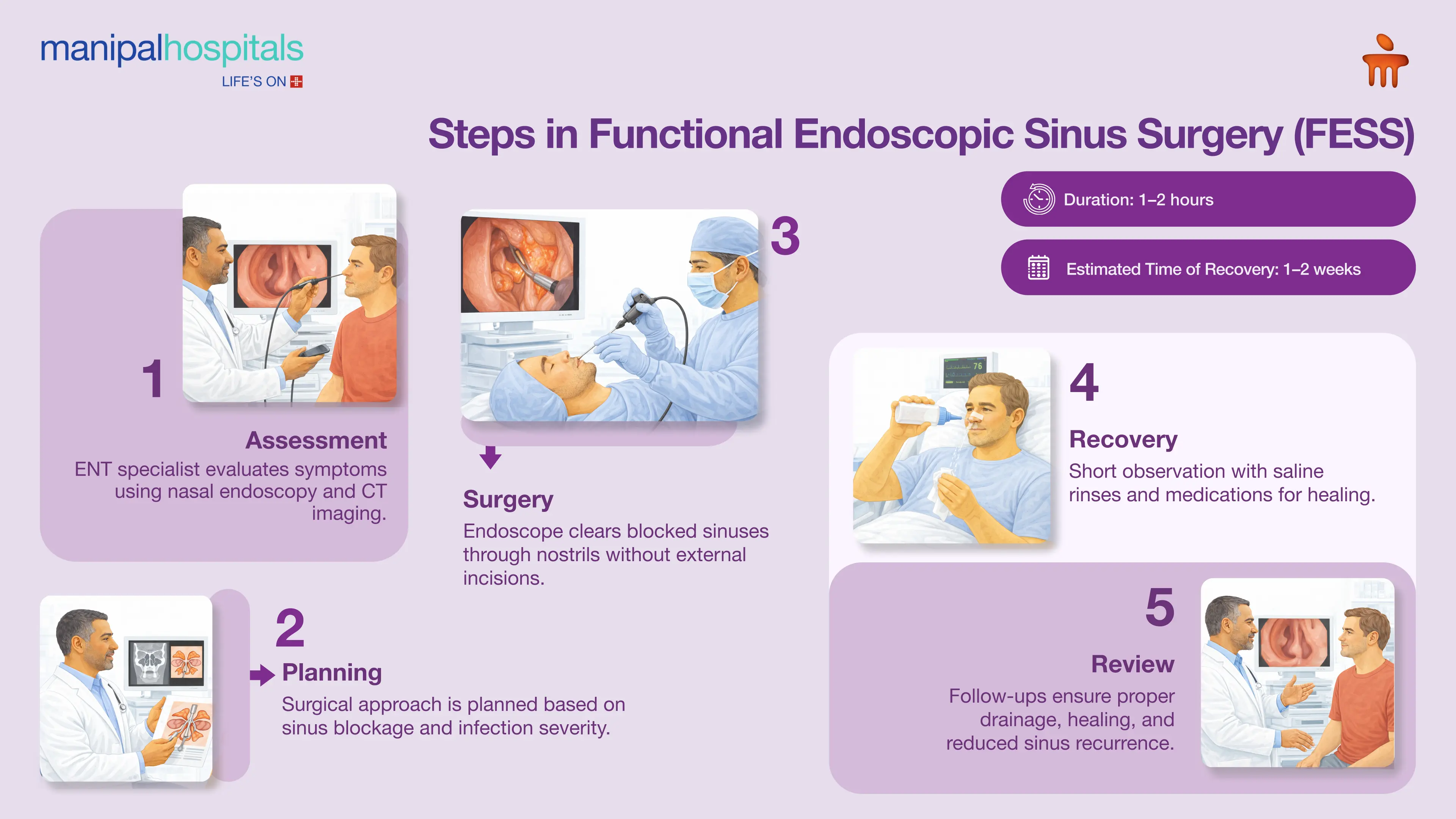 FESS Surgery in Bangalore | Manipal Hospitals