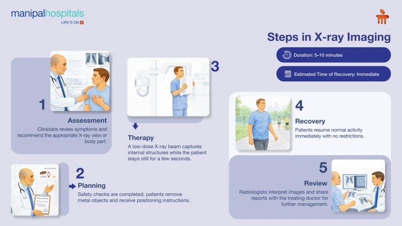 Digital X Ray in Siliguri for Accurate Diagnosis | Manipal Hospitals