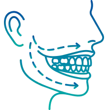 Jaw Surgery in Bangalore | Manipal Hospitals