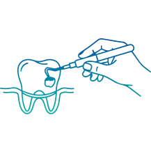 Best Dental Cleaning in Delhi | Manipal Hospitals