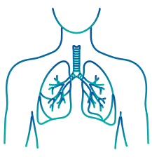 Lung Transplant in Bangalore | Manipal Hospitals