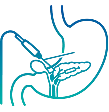 ERCP Test in Delhi | Manipal Hospitals