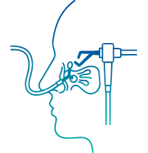 FESS Surgery in Bangalore | Manipal Hospitals