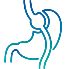 Gastric Bypass Surgery in India | Manipal Hospitals