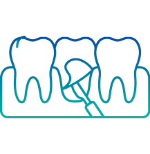 Gum Surgery in Bangalore | Manipal Hospitals