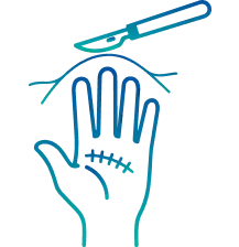 Hand Surgery in Delhi | Manipal Hospitals