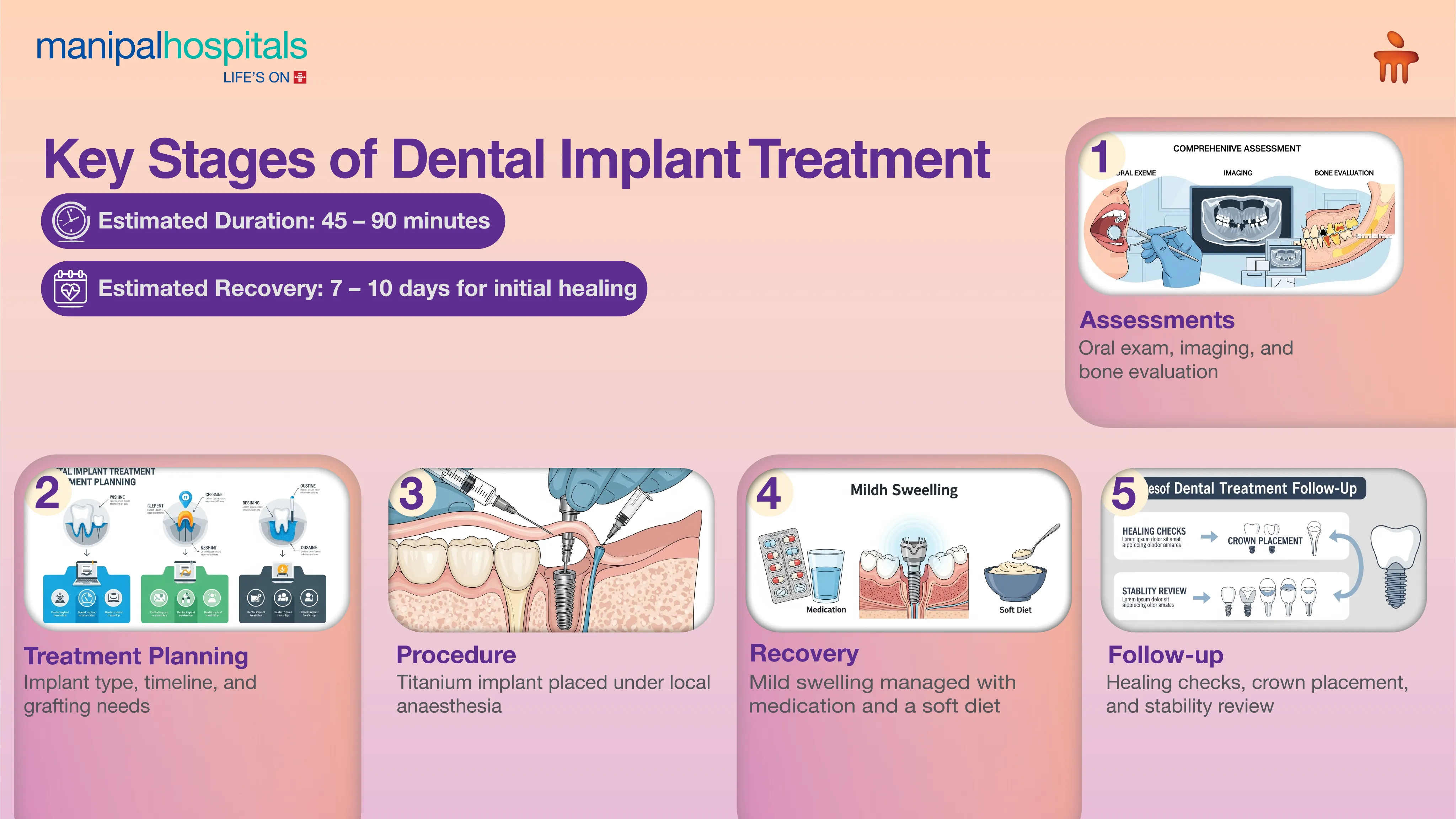Dental Implants in India | Manipal Hospitals