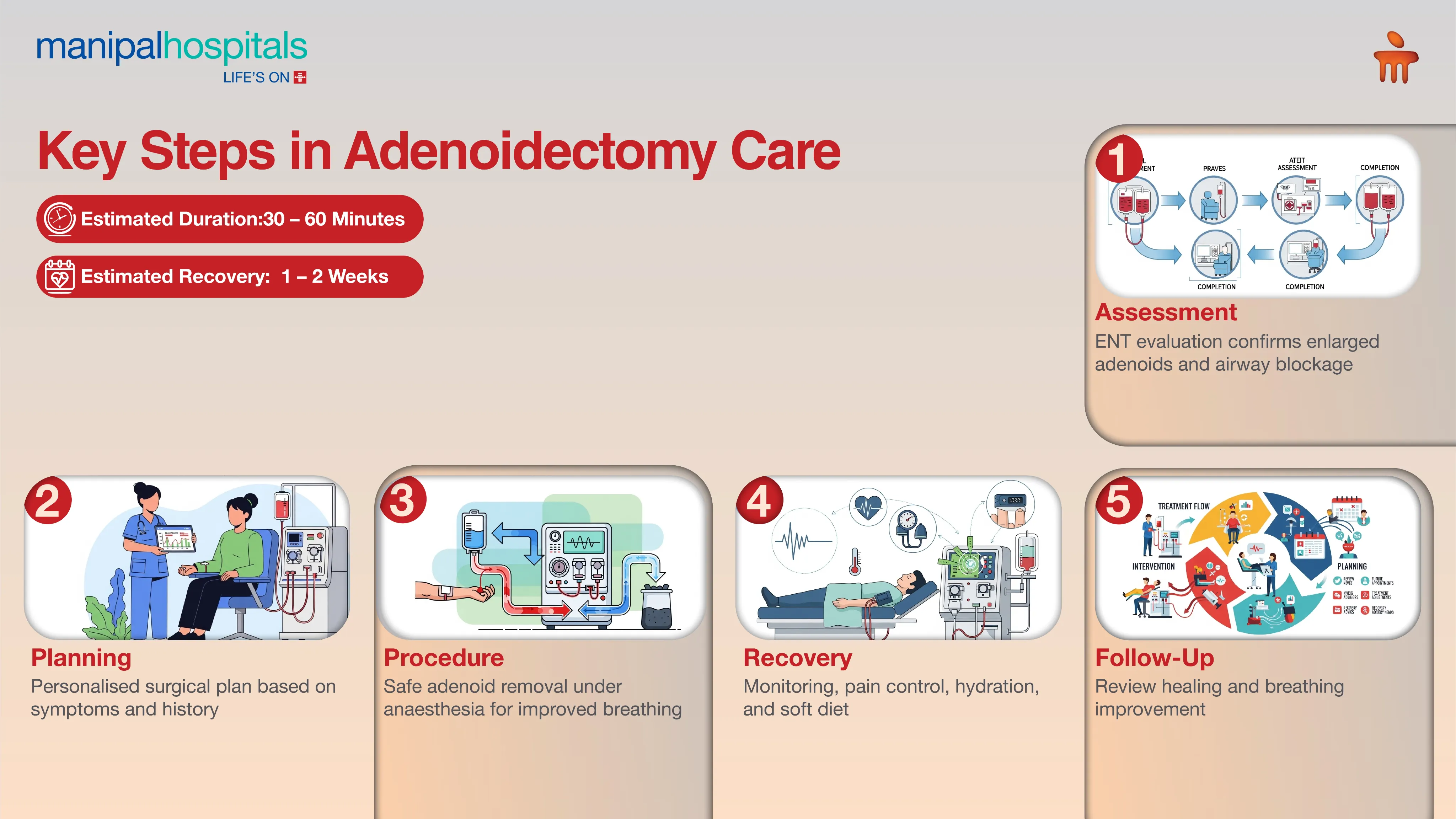 Adenoidectomy Surgery in India | Manipal Hospitals