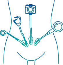 Laparoscopy in Bangalore | Manipal Hospitals