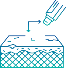 Laser Skin Resurfacing Treatment in India | Manipal Hospitals