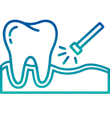 Best Gum Treatment in Delhi | Manipal Hospitals