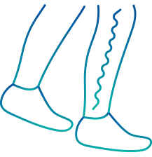 Limb Salvage Surgery in Bangalore | Manipal Hospitals