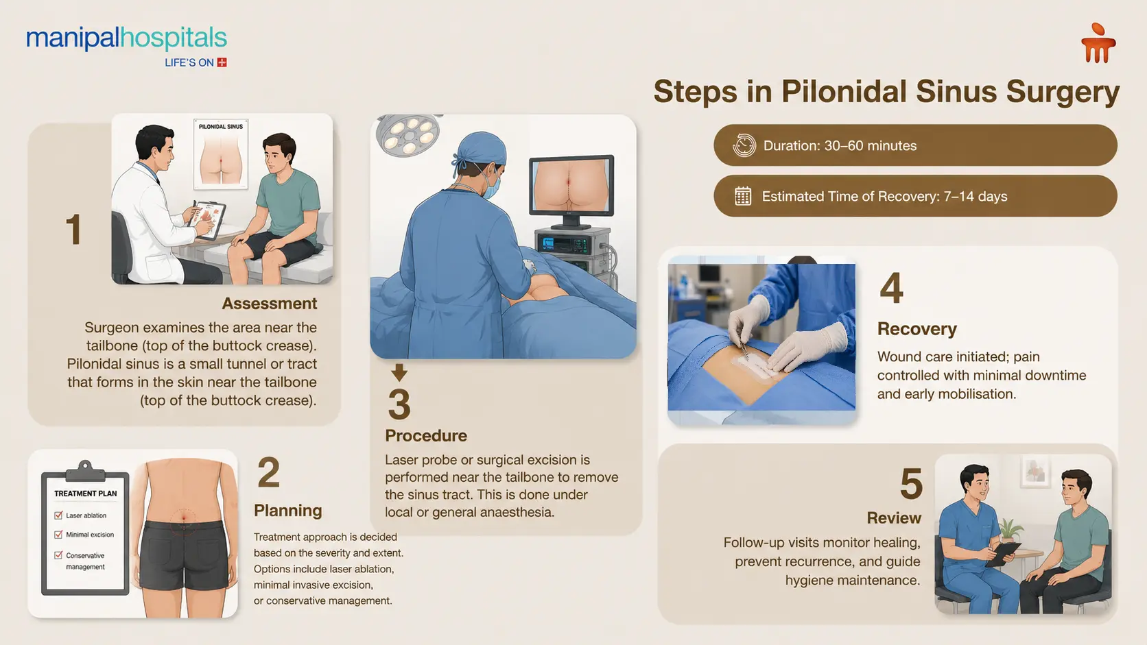Pilonidal Sinus Laser Surgery in Bangalore | Manipal Hospitals