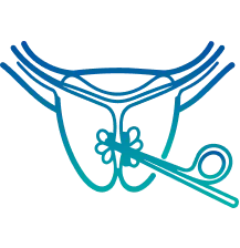 Prostate Surgery in Delhi | Manipal Hospitals