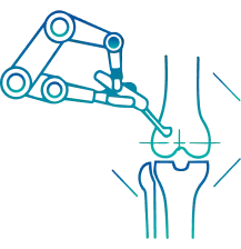Robotic Knee Replacement in Delhi | Manipal Hospitals