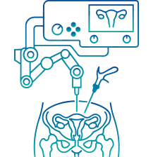 Robotic Gynecological Surgery in India | Manipal Hospitals