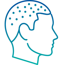 Scalp Micropigmentation in Pune | Manipal Hospitals