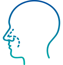 Septoplasty in Bangalore | Manipal Hospitals