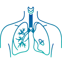Lung Transplant in Bangalore | Manipal Hospitals