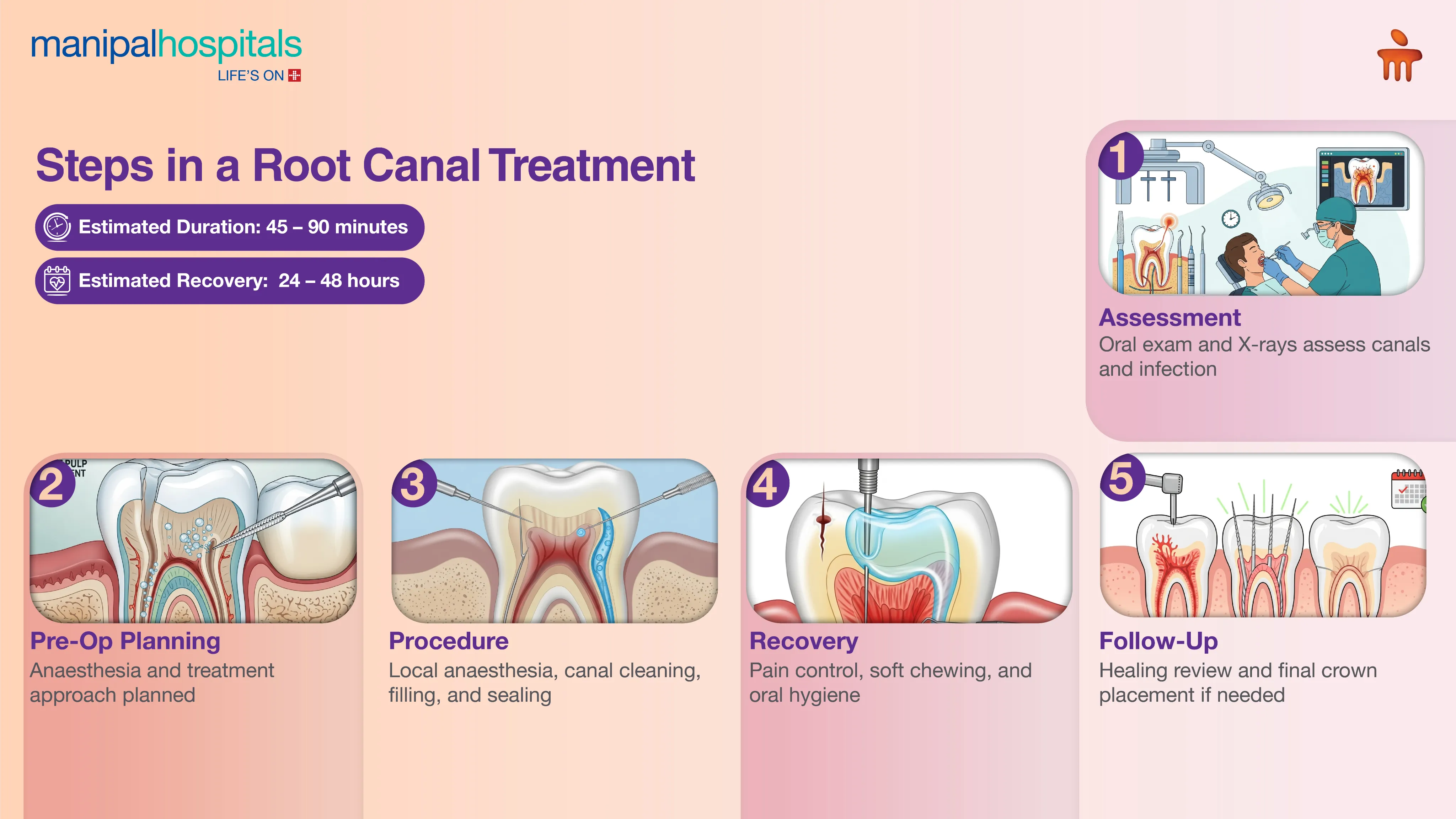 Root Canal Treatment in India | Manipal Hospitals