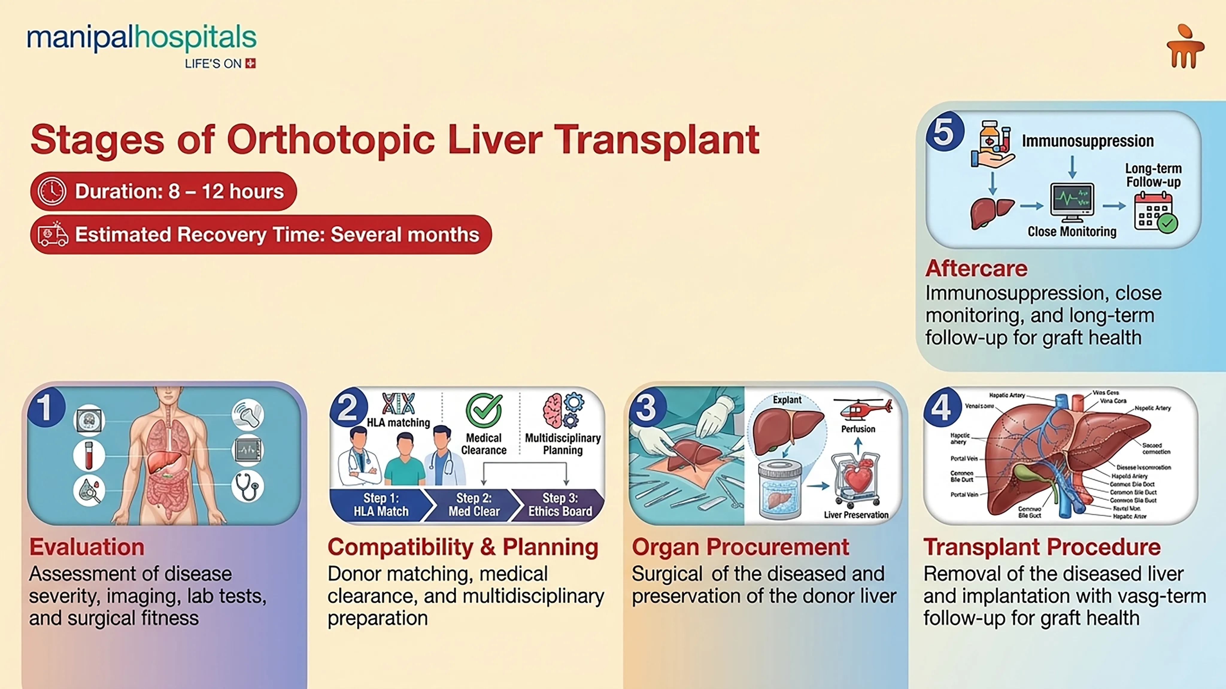 Orthotopic Liver Transplant in India | Manipal Hospitals