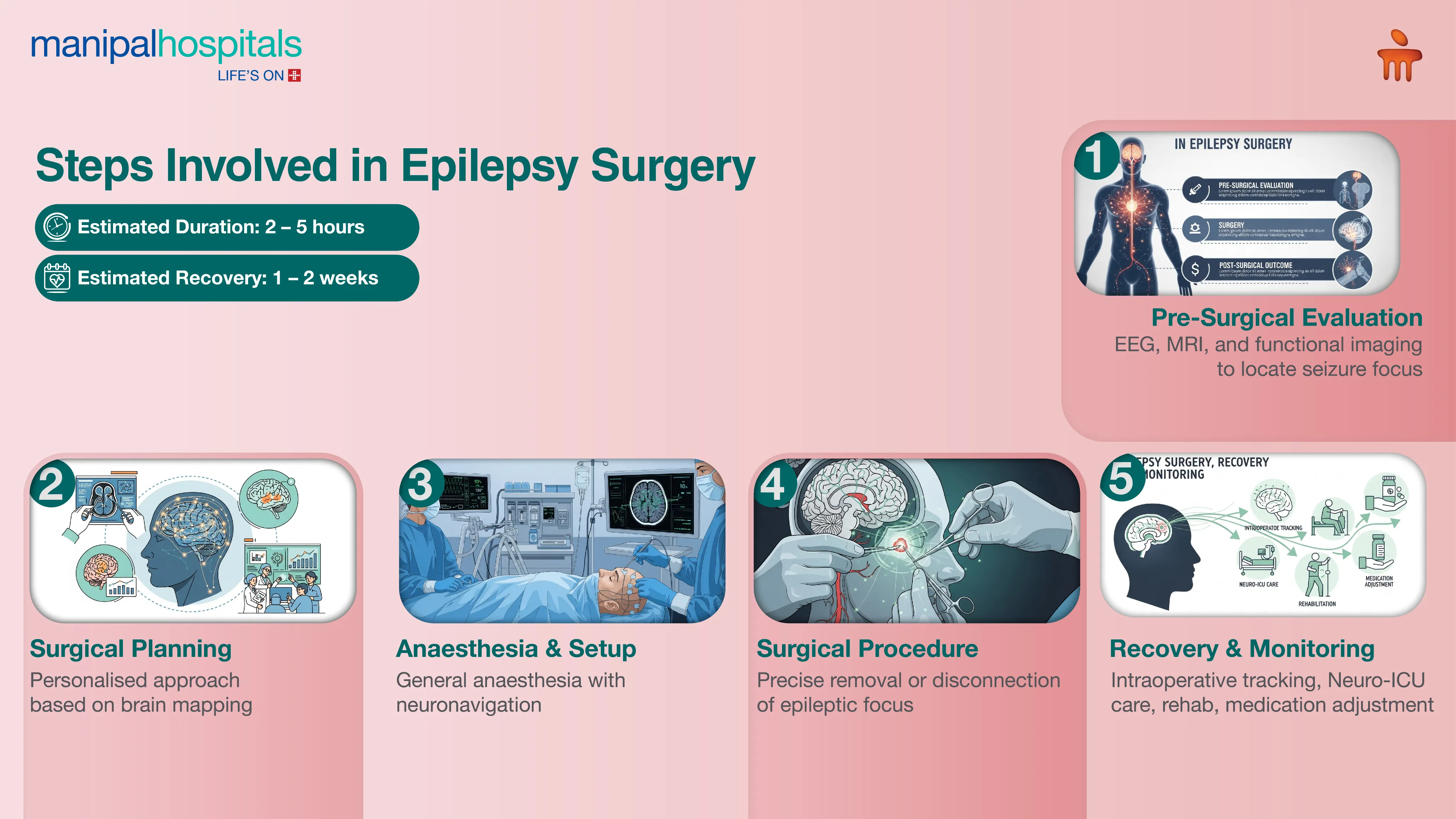 Epilepsy Surgery in Pune | Manipal Hospitals