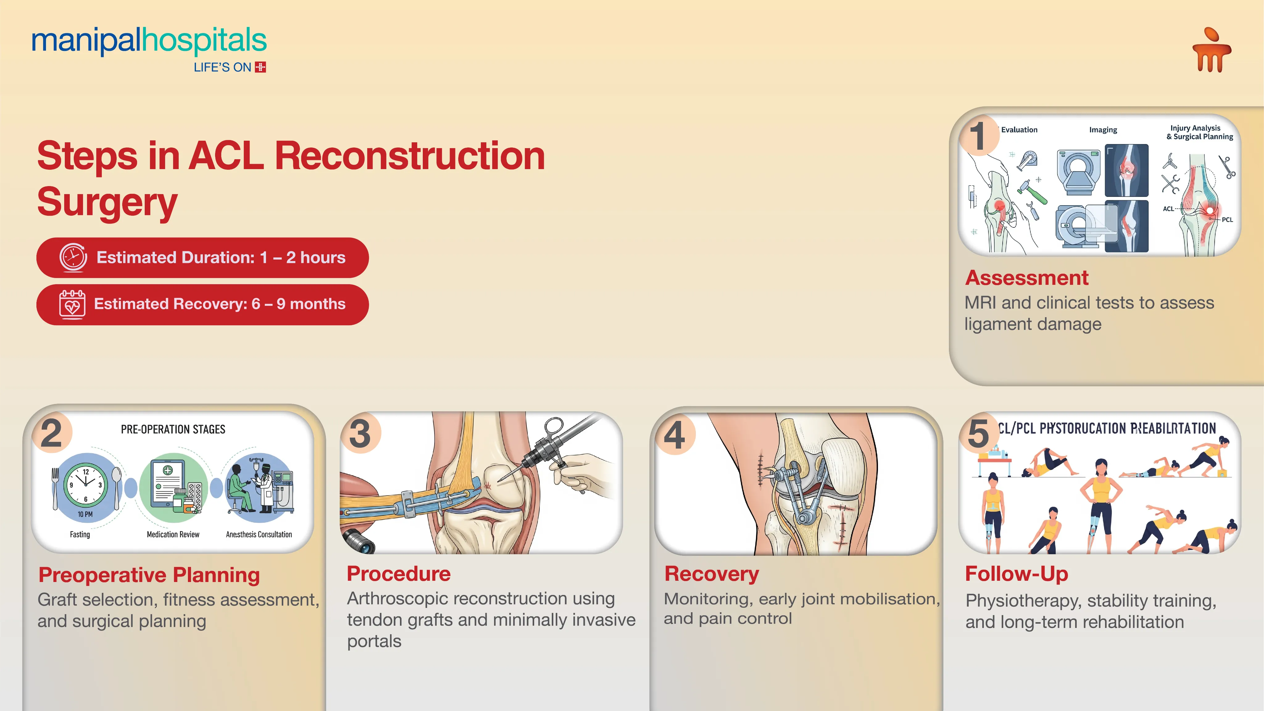 ACL / PCL Reconstruction Surgery in India | Manipal Hospitals