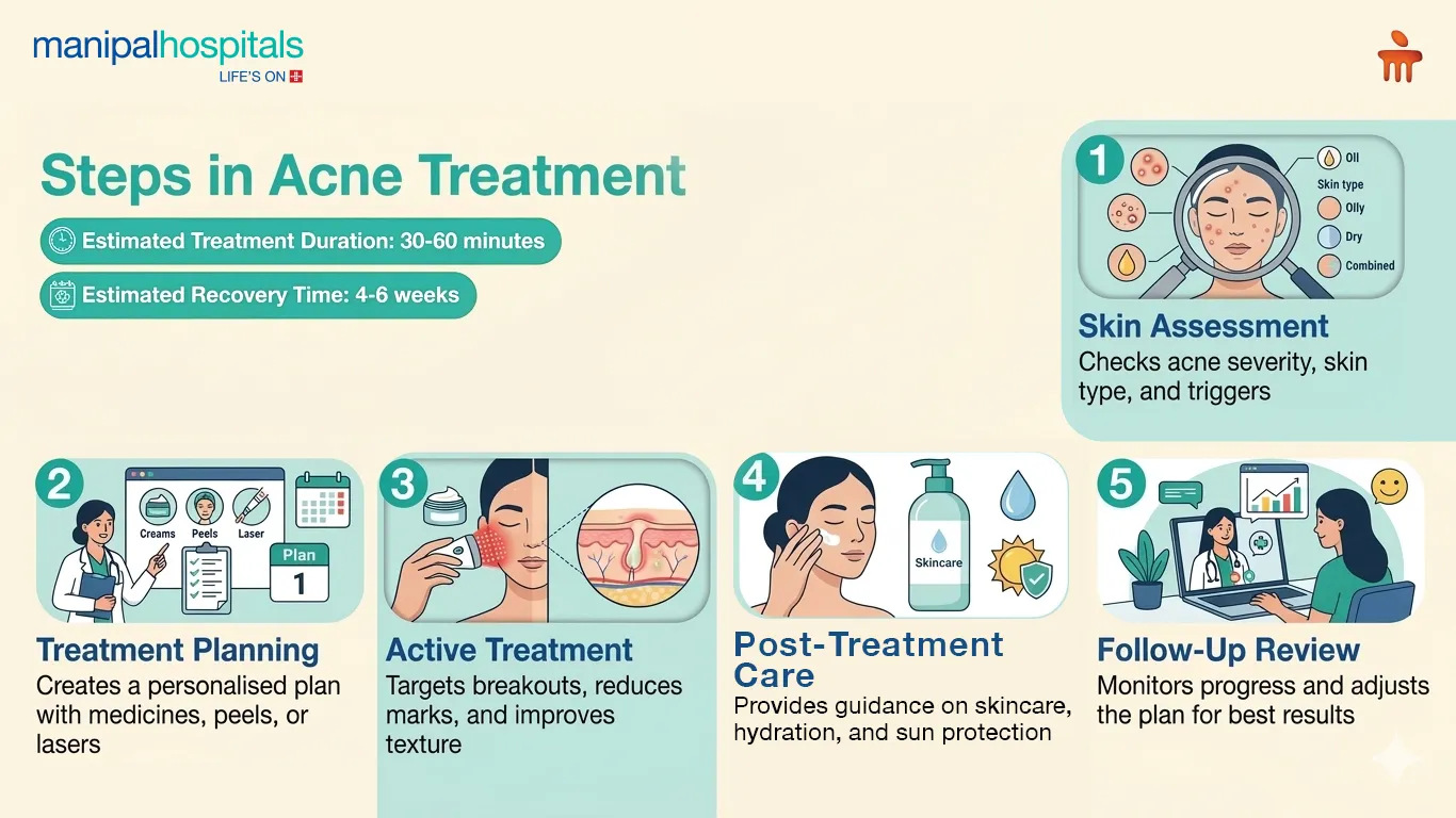 Acne Treatment in India | Manipal Hospitals